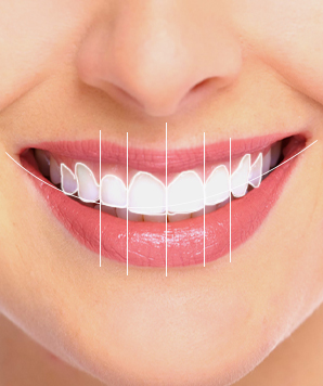 Dental clinic in nagpur - Digital Smile Design (DSD)